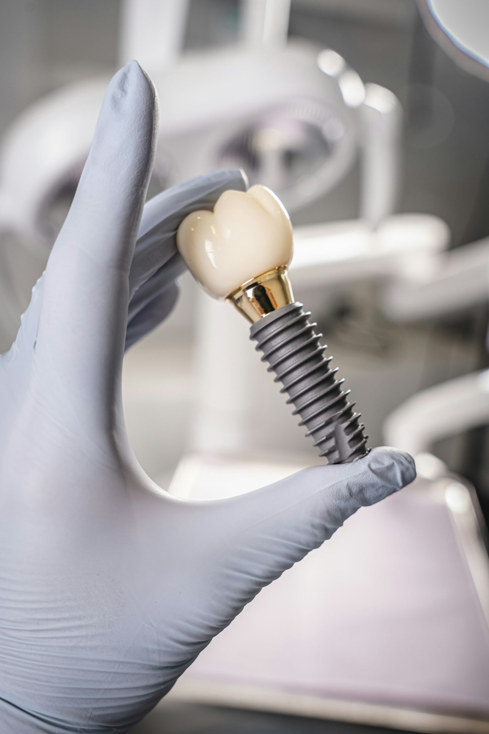 Mână cu mănușă ținând un implant dentar cu bontul și coroana