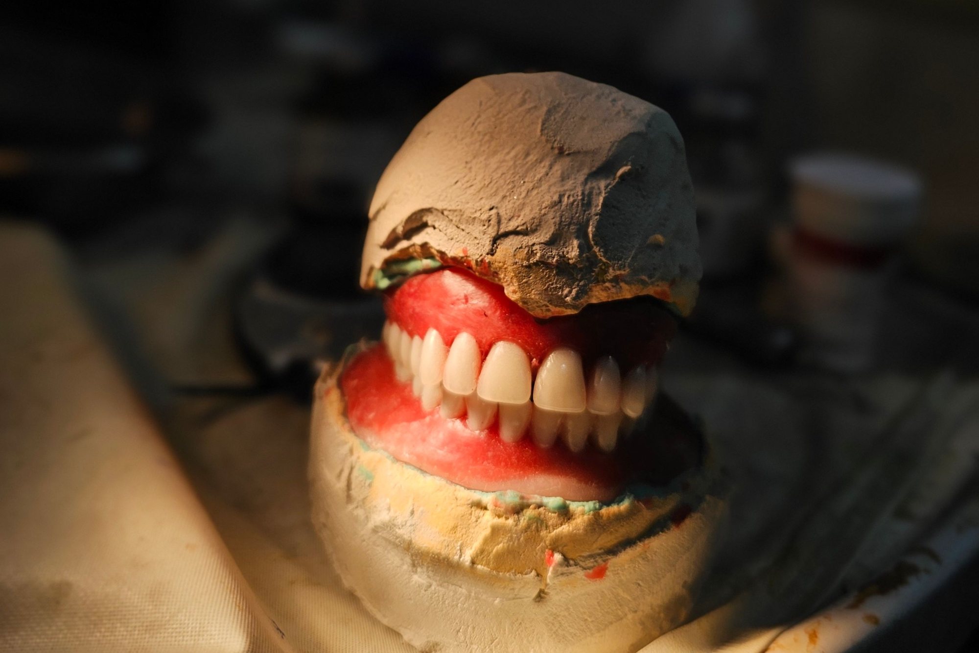 Lucrare dentară pe toată arcada, pe un model din ghips, în laboratorul de tehnică dentară